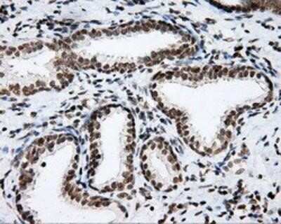 Immunohistochemistry-Paraffin: SHC1 Antibody (OTI3A1) [NBP2-02434]