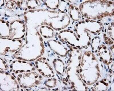 Immunohistochemistry-Paraffin: SHC1 Antibody (OTI3A1) [NBP2-02434]