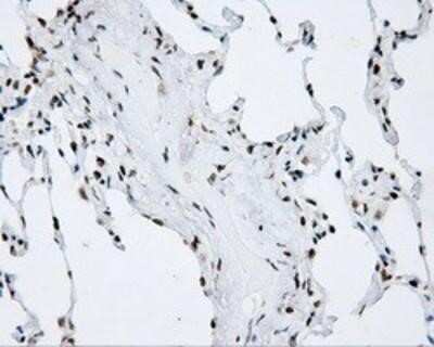 Immunohistochemistry-Paraffin: SHC1 Antibody (OTI3A1) [NBP2-02434]