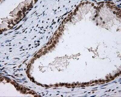 Immunohistochemistry-Paraffin: SHC1 Antibody (OTI3A1) [NBP2-02434]