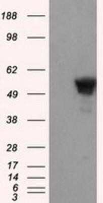 Western Blot: SHC1 Antibody (OTI3A1) [NBP2-02434]