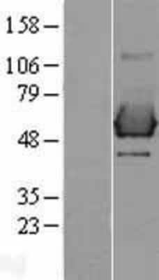 Western Blot: SHC1 Overexpression Lysate [NBL1-15936]