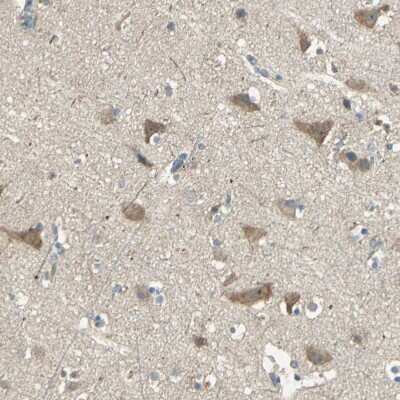 Immunohistochemistry-Paraffin: SHC2 Antibody [NBP1-87076]