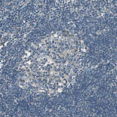 Immunohistochemistry-Paraffin: SHC2 Antibody [NBP1-87076]