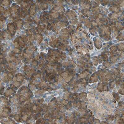 Immunohistochemistry-Paraffin: SHC2 Antibody [NBP1-87076]