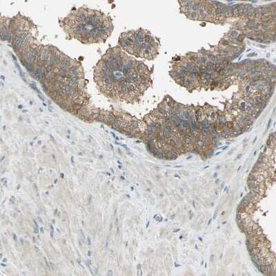 Immunohistochemistry-Paraffin: SHC2 Antibody [NBP1-87076]