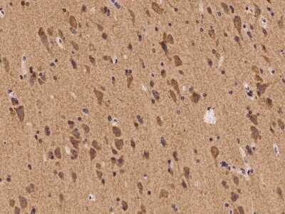 Immunohistochemistry-Paraffin: SHC2 Antibody [NBP2-98061]