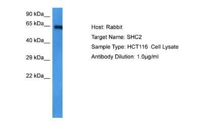 Western Blot: SHC2 Antibody [NBP2-85723]