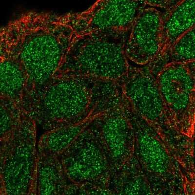 Immunocytochemistry/ Immunofluorescence: SHC3 Antibody [NBP2-56058]