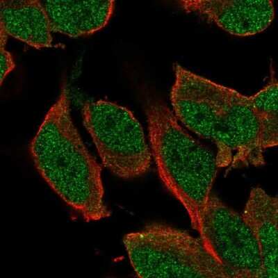 Immunocytochemistry/ Immunofluorescence: SHC3 Antibody [NBP2-58795]