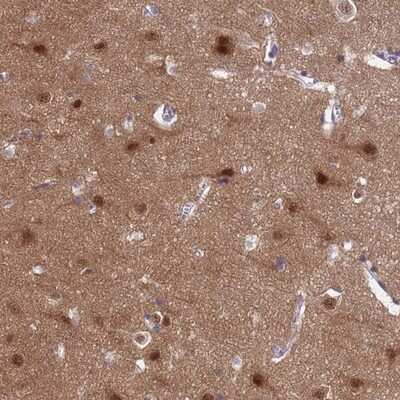 Immunohistochemistry-Paraffin: SHC3 Antibody [NBP2-13307]