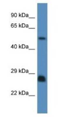 Western Blot: SHC3 Antibody [NBP1-79656]