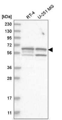 Western Blot: SHC3 Antibody [NBP2-58795]