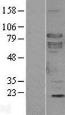 Western Blot: SHC4 Overexpression Lysate [NBL1-15937]