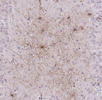 Immunohistochemistry-Paraffin: SHCBP1 Antibody [NBP2-31881]