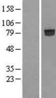 Western Blot: SHCBP1 Overexpression Lysate [NBL1-15938]