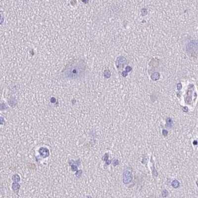 Immunohistochemistry-Paraffin: SHCBP1L Antibody [NBP1-90716]