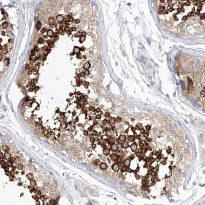 Immunohistochemistry-Paraffin: SHCBP1L Antibody [NBP2-32716]