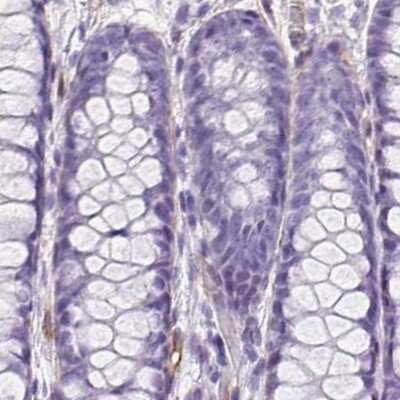 Immunohistochemistry-Paraffin: SHCBP1L Antibody [NBP2-39034]