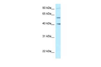 Western Blot: SHCBP1L Antibody [NBP2-88268]