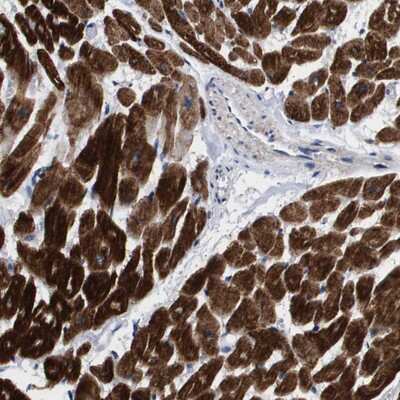 Immunohistochemistry-Paraffin: SHD Antibody [NBP1-86053]