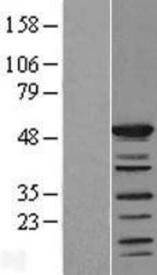 Western Blot: SHD Overexpression Lysate [NBL1-15939]