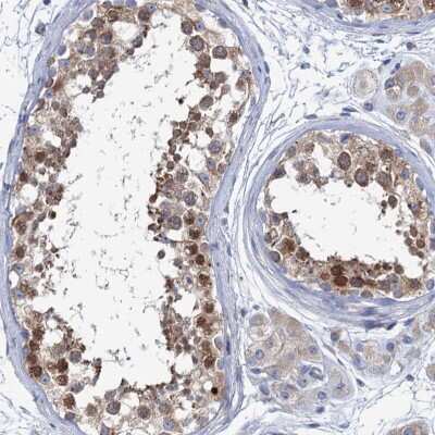 Immunohistochemistry-Paraffin: SHE Antibody [NBP1-90996]