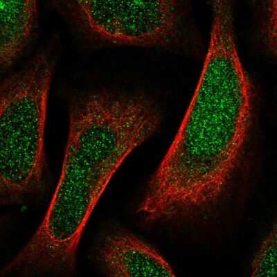 Immunocytochemistry/ Immunofluorescence: SHF Antibody [NBP2-56117]