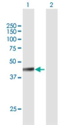 Western Blot: SHFM3 Antibody [H00006468-B01P]