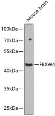 Western Blot: SHFM3 AntibodyBSA Free [NBP2-93850]