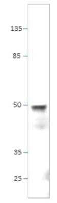 Western Blot: SHFM3 Antibody [NBP3-12201]