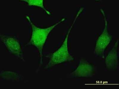 Immunocytochemistry/ Immunofluorescence: SHFM3P1 Antibody (2C5) [H00026226-M15]