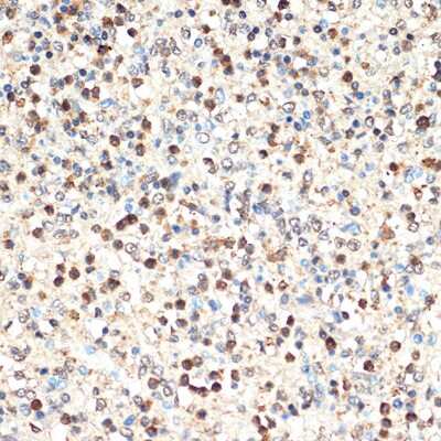 Immunohistochemistry-Paraffin: SHIP Antibody (2F8U0) [NBP3-16226]