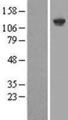 Western Blot: SHIP Overexpression Lysate [NBL1-12000]