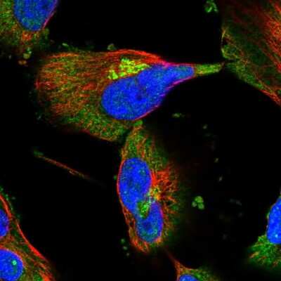 Immunocytochemistry/ Immunofluorescence: SHIP2/INPPL1 Antibody [NBP1-87046]