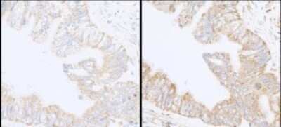 Immunohistochemistry: SHIP2/INPPL1 Antibody [NB100-1592]