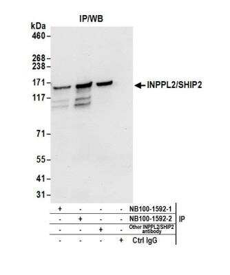 Immunoprecipitation: SHIP2/INPPL1 Antibody [NB100-1592]