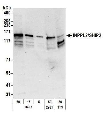 Western Blot: SHIP2/INPPL1 Antibody [NB100-1592]