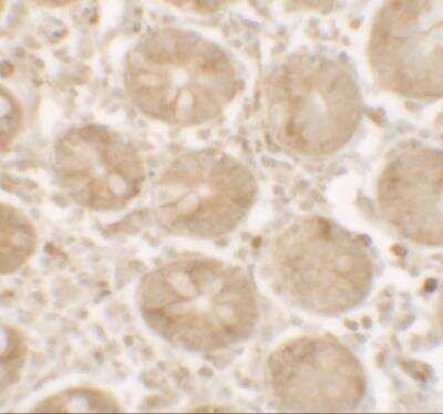 Immunohistochemistry: SHISA3 Antibody - BSA Free [NBP2-22340]