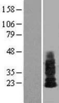 Western Blot: Shisa-4 Overexpression Lysate [NBL1-15943]