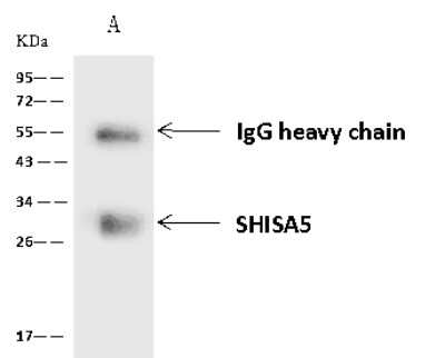 Immunoprecipitation: SHISA5 Antibody [NBP2-97841]