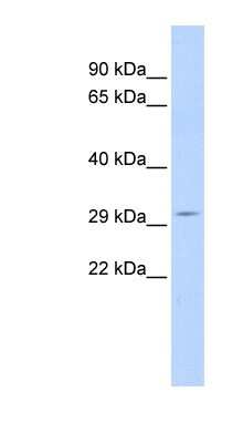 Western Blot: SHISA5 Antibody [NBP1-59053]