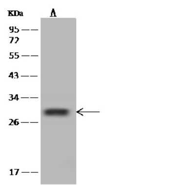 Western Blot: SHISA5 Antibody [NBP2-97841]