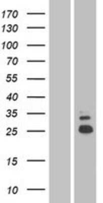 Western Blot: SHISA5 Overexpression Lysate [NBP2-04356]