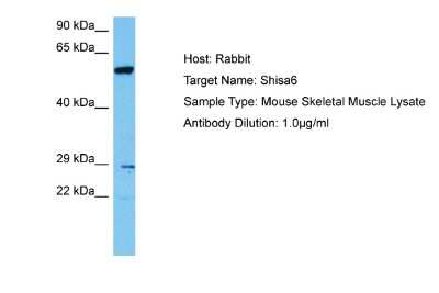 Western Blot: SHISA6 Antibody [NBP2-85726]