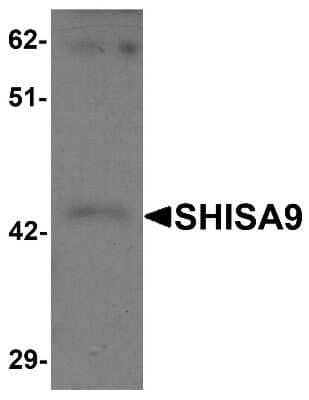 Western Blot: SHISA9 AntibodyBSA Free [NBP1-76496]