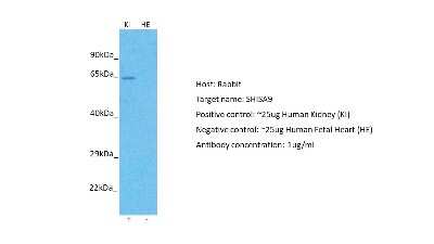 Western Blot: SHISA9 Antibody [NBP2-84259]