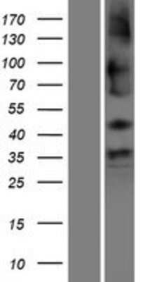 Western Blot: SHISA9 Overexpression Lysate [NBP2-09730]