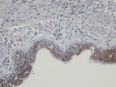 Immunohistochemistry-Paraffin: SHKBP1 Antibody [NBP1-31451]