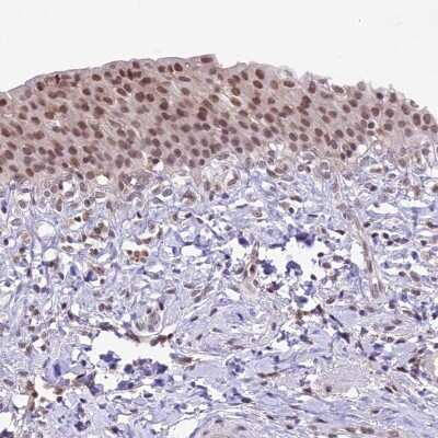 Immunohistochemistry-Paraffin: SHKBP1 Antibody [NBP1-87252]